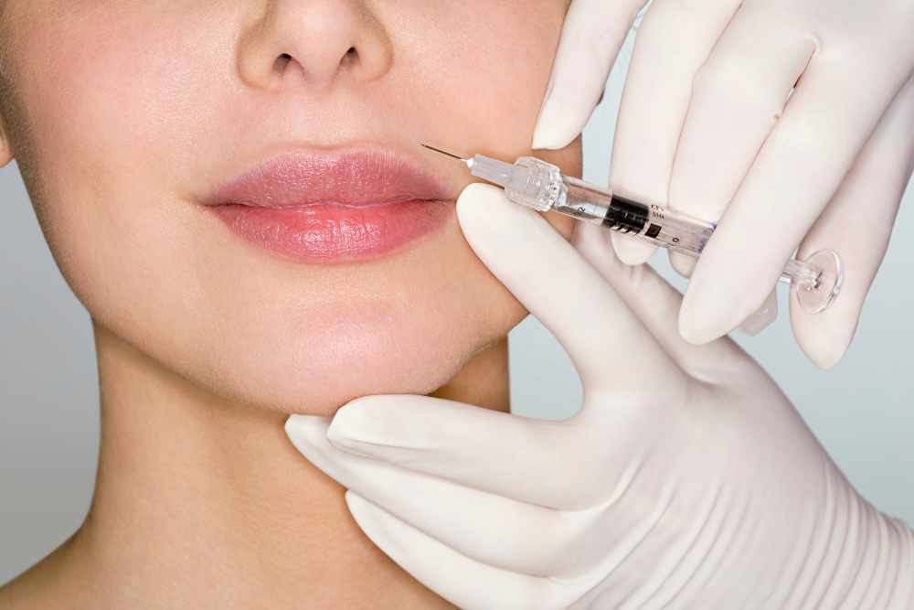 Dermal Filler in Charlotte