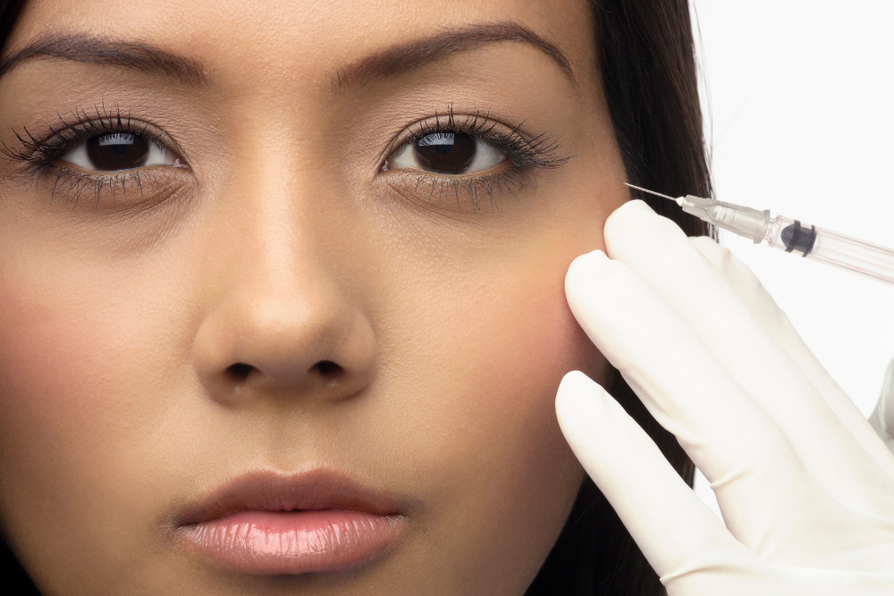Wrinkle reduction